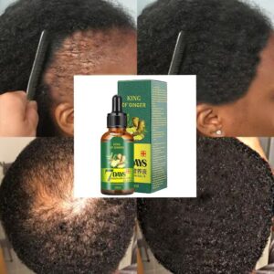 7 Days Hair Growth Oil